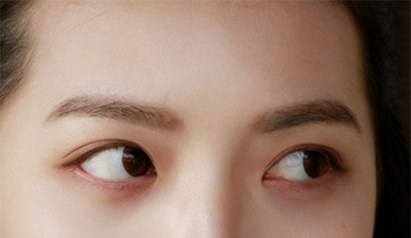 眼睛痒是怎么回事 哪些因素会引起眼睛痒